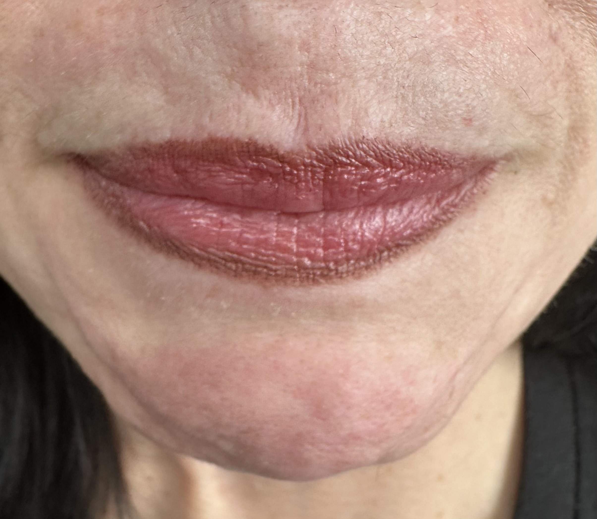 Witches chins belong in the movies, let’s smooth them away